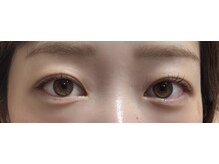 ソワドットハチハチ(Soi.88)/まつ毛パーマ（上のみ）