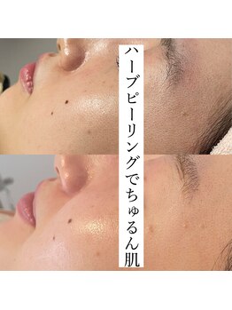 クウラ 学園前店(KUULa)/きめ細やかな肌