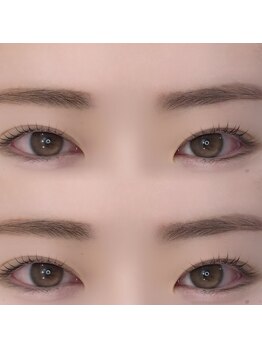 シーンスタジオ 原宿店(SSIN STUDIO)/まつげパーマ/原宿店/マツパ