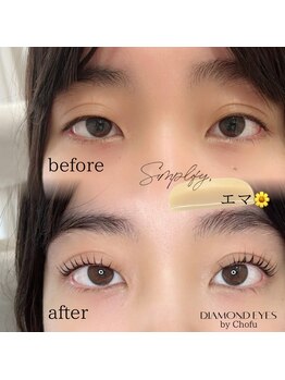 ダイヤモンドアイズ 調布店(DIAMOND EYES)/エマロッド ビフォーアフター