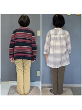 ユウ(You)/60代・背骨の歪み＆猫背