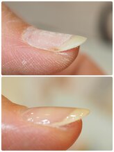 プライベートネイルサロン ママネイル(mamanail)/フィルイン一層残し対応☆