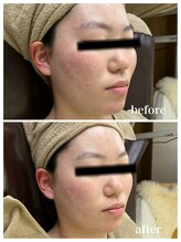 ジャスミン(Jasmin)/オーダーメイド高濃度原液導入