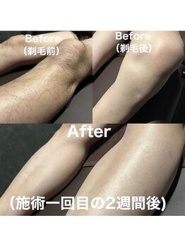 ドシースキンラボ(℃ SKINLAB)/症例2