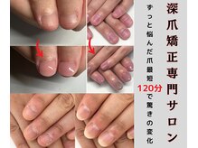 クウ(KUU)の雰囲気（即日見た目改善できるからその日から楽しく深爪矯正できる!）