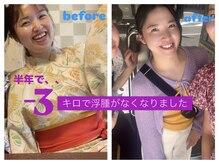 キュル(Kyul)/よもぎ蒸しで半年で変わりました