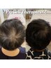 【プロセルセラピーズで驚異の育毛促進】抜け毛やボリューム頭皮のお悩みに◎