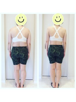 ホロニック ベルサンテ(Holonic Belle Sante)/メディセルハイブリッド