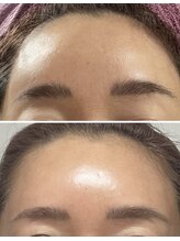 ICDスキンスタジオ 新宿三丁目(ICD-skin studio)/Before-After