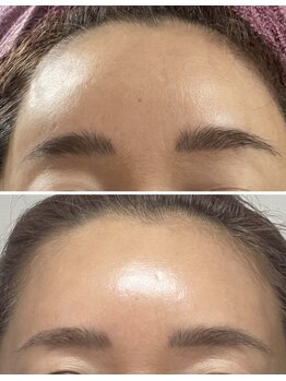 ICDスキンスタジオ 新宿三丁目(ICD-skin studio)/Before-After