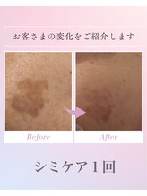 ヴィアージュ(Viage)/