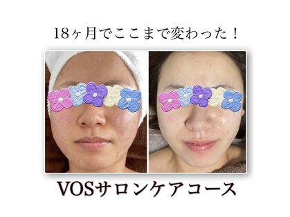 ルアナライフ(Luana Life)の写真