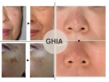 ギア ヘルス(GHIA health)の写真/隠すのはもう終わり！鏡を見るたび気になるシミ・しわに☆今から始める本気の肌ケアで未来の肌まで整える◎
