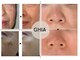 ギア ヘルス(GHIA health)の写真/隠すのはもう終わり！鏡を見るたび気になるシミ・しわに☆今から始める本気の肌ケアで未来の肌まで整える◎