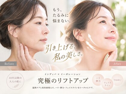 アキュセル 高槻(Accu:cell)の写真