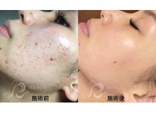 ベルメイク(BELLE MAKE)/リベル☆ビフォーアフター