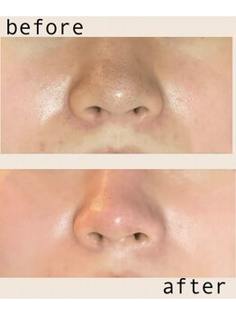 ムーンライズ(moonrise)/