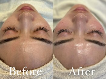 ザ パールズ(The Pearls)/毎月の継続で内側から発光