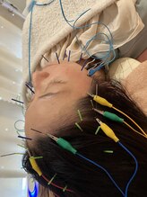 瑞 鍼灸院/頭皮鍼+美容鍼