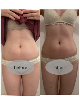 マホロバ セカンド(mahoroba 2nd)/黄土よもぎ蒸し＋腸マッサージ