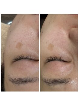 ジャスミン(Jasmine)/