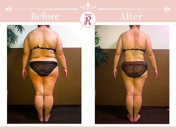 サロン アール(Salon R)/痩身施術×食事・インナーケア
