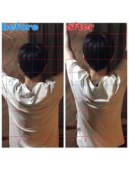 春日部コアラ整体院/Before→After(肩の外転)