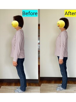 佳整体 大宮/整体操法後の身体_側面