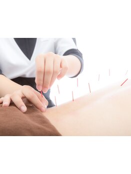 鍼灸施術を受けたい