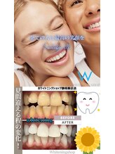 ホワイトニングショップ 葵区静岡駅店/ホワイトニング店ホワイトニング