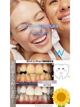 ホワイトニングショップ 葵区静岡駅店/ホワイトニング店ホワイトニング