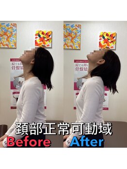 ヒデ整体院(Hide整体院)/猫背矯正骨盤矯正B/A肩こり腰痛