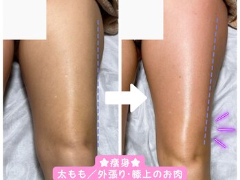 サロンドモモ(SALON de MOMO)/痩身★下半身ビフォーアフター