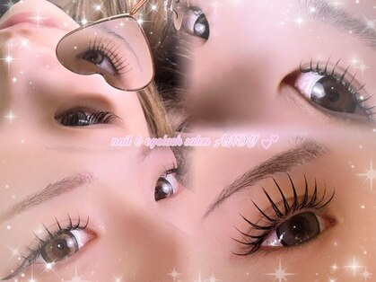アンディ(ANDY)の写真