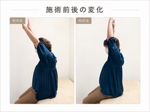 テラス 千葉(TERAS)の雰囲気（不調のある部分だけではなく、土台の関節や筋肉もしっかりケア）
