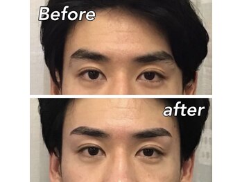 スター 新宿 新宿御苑(★STAR)/施術例　新宿メンズ眉毛