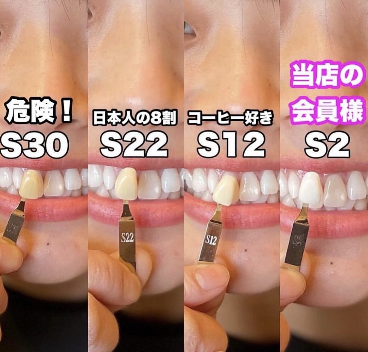 ホワイトサロン｜ホットペッパービューティー