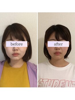 小顔革命 小顔 全身美容矯正専門店/小顔矯正+顎関節矯正