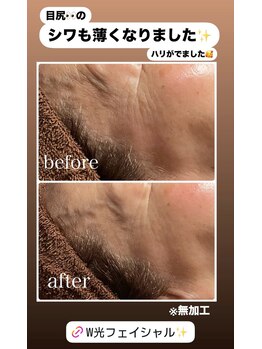 イーストモア(EAST MOIS)/60代女性ハリ弾力☆