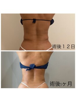 サロンシファ(salon sifa)/術後ケア