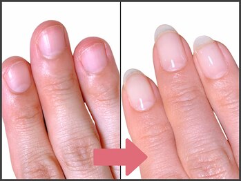 アモ 坂戸(’Amo)/深爪矯正・自爪育成 坂戸/北坂戸