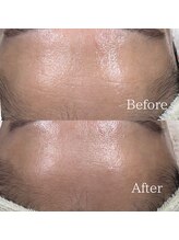 メイス 福井店(MEIS)/お客様Before、After