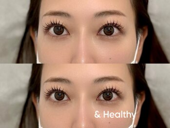 ニコ(Niko)/アンドヘルシー100本