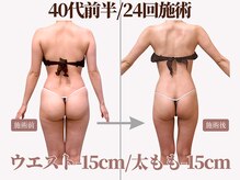 丁寧なカウンセリングでお悩みが解決する通い方をご提案します☆