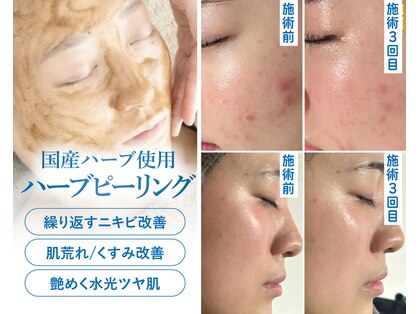 マーミューズ 宮町店&花樹の写真