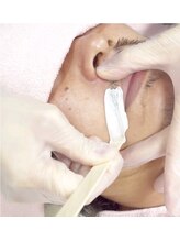 キナリ(kinari)/ヒゲワックス脱毛