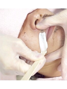 キナリ(kinari)/ヒゲワックス脱毛