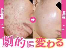 ホワイトアクア 京都店(WHITE AQUA)の雰囲気(全国約60店舗展開中の肌管理専門店★WHITE AQUA)