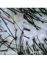 モモ 札幌(MOMO.)/ヘッドスパ後の毛穴の状態