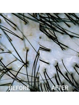 モモ 札幌(MOMO.)/ヘッドスパ後の毛穴の状態